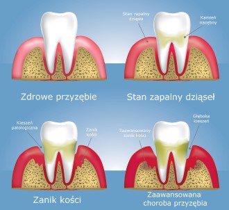 Periodontologia